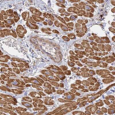 Immunohistochemistry-Paraffin MRPL15 Antibody