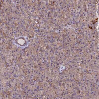 Immunohistochemistry-Paraffin MRPL15 Antibody