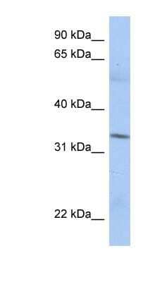 Western Blot: MRPL15 Antibody [NBP1-54662] - PANC1 cell lysate, concentration 0.2-1 ug/ml.