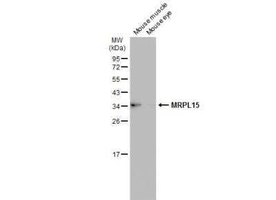 Western Blot MRPL15 Antibody