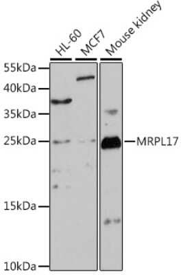 Western Blot: MRPL17 Antibody [NBP2-94299] - Analysis of extracts of various cell lines, using MRPL17 at 1:1000 dilution.Secondary antibody: HRP Goat Anti-Rabbit IgG (H+L) at 1:10000 dilution.Lysates/proteins: 25ug per lane.Blocking buffer: 3% nonfat dry milk in TBST.Detection: ECL Basic Kit .Exposure time: 3min.