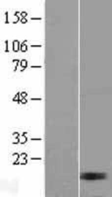 Western Blot: MRPL17 Overexpression Lysate (Adult Normal) [NBL1-13240] Left-Empty vector transfected control cell lysate (HEK293 cell lysate); Right -Over-expression Lysate for MRPL17.