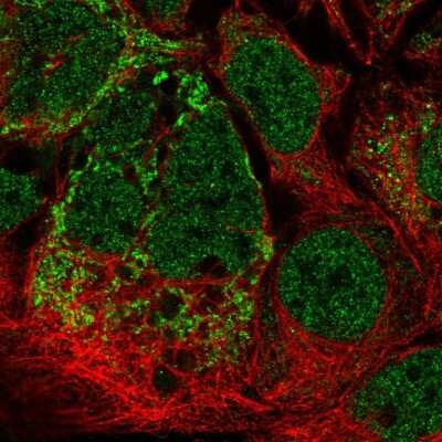 Immunocytochemistry/Immunofluorescence: MRPL2 Antibody [NBP2-57589] - Staining of human cell line CACO-2 shows localization to nucleoplasm & mitochondria.
