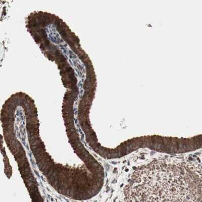 Immunohistochemistry-Paraffin: MRPL2 Antibody [NBP1-84513] - Staining of human gallbladder shows strong cytoplasmic positivity in glandular cells.