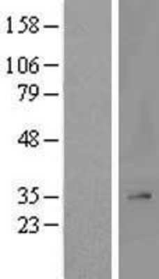 Western Blot: MRPL2 Overexpression Lysate (Adult Normal) [NBL1-13243] Left-Empty vector transfected control cell lysate (HEK293 cell lysate); Right -Over-expression Lysate for MRPL2.