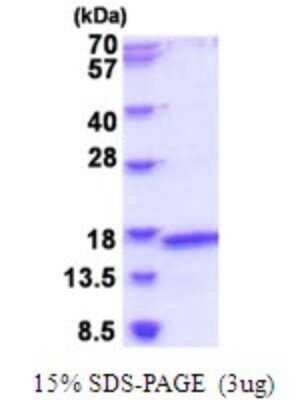 SDS-Page: MRPL2 Recombinant Protein [NBP2-51912] - 15% SDS Page (3 ug)