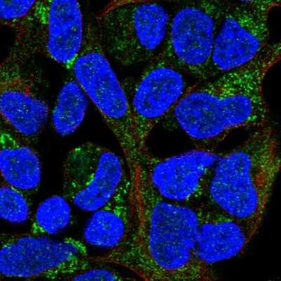 Immunocytochemistry/ Immunofluorescence MRPL20 Antibody