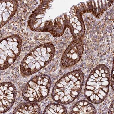 Immunohistochemistry-Paraffin MRPL20 Antibody