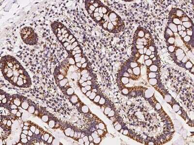 Immunohistochemistry-Paraffin: MRPL20 Antibody [NBP2-98645] - Staining of human MRPL20 in human kidney with rabbit polyclonal antibody at 1:100 dilution.