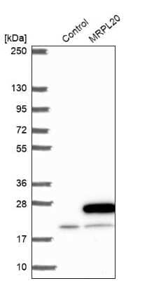 Western Blot MRPL20 Antibody