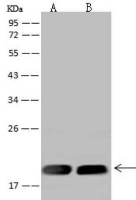 Western Blot: MRPL20 Antibody [NBP2-98645] - Lane A: HeLa Whole Cell LysateLane B: U-251 MG Whole Cell LysateLysates/proteins at 30 ug per lane.SecondaryGoat Anti-Rabbit IgG (H+L)/HRP at 1/10000 dilution.Developed using the ECL technique.Performed under reducing conditions.Predicted band size:17 kDaObserved band size:20 kDa