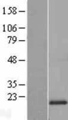 Western Blot: MRPL20 Overexpression Lysate (Adult Normal) [NBL1-13244] Left-Empty vector transfected control cell lysate (HEK293 cell lysate); Right -Over-expression Lysate for MRPL20.