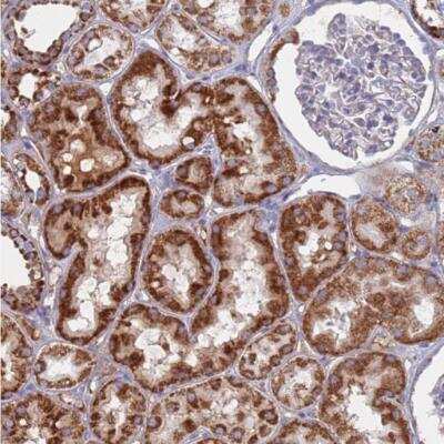 Immunohistochemistry-Paraffin MRPL22 Antibody