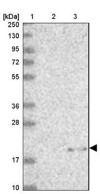 Western Blot MRPL22 Antibody