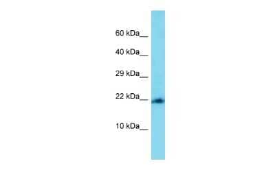 Western Blot: MRPL22 Antibody [NBP2-85315] - Host: Rabbit. Target Name: Mrpl22. Sample Type: Mouse Heart lysates. Antibody Dilution: 1.0ug/ml