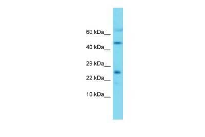 Western Blot: MRPL22 Antibody [NBP2-85316] - Host: Rabbit. Target Name: Mrpl22. Sample Type: Mouse Heart lysates. Antibody Dilution: 1.0ug/ml