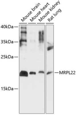 Western Blot: MRPL22 Antibody [NBP2-93701] - Analysis of extracts of various cell lines, using MRPL22 at 1:1000 dilution.Secondary antibody: HRP Goat Anti-Rabbit IgG (H+L) at 1:10000 dilution.Lysates/proteins: 25ug per lane.Blocking buffer: 3% nonfat dry milk in TBST.Detection: ECL Basic Kit .Exposure time: 30s.