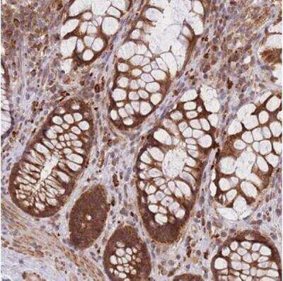 Immunohistochemistry-Paraffin: MRPL23 Antibody [NBP2-30918] - Staining of human rectum shows strong cytoplasmic positivity in glandular cells.