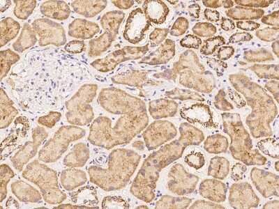Immunohistochemistry-Paraffin: MRPL23 Antibody [NBP3-06349] - Immunochemical staining of human MRPL23 in human kidney with rabbit polyclonal antibody at 1:500 dilution, formalin-fixed paraffin embedded sections.