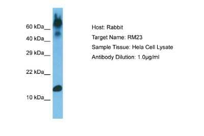 Western Blot: MRPL23 Antibody [NBP2-83226] - Host: Rabbit. Target Name: RM23. Sample Type: Hela Whole Cell. Antibody Dilution: 1.0ug/ml