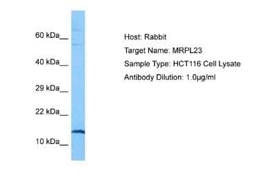 Western Blot: MRPL23 Antibody [NBP2-83227] - Host: Rabbit. Target Name: MRPL23. Sample Tissue: HCT116 Whole Cell lysates. Antibody Dilution: 1.0ug/ml