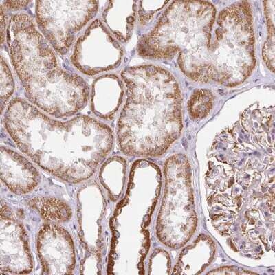 Immunohistochemistry: MRPL24 Antibody [NBP2-68709] - Immunohistochemical staining of human kidney shows strong cytoplasmic positivity in renal tubules.