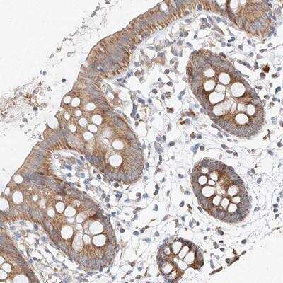 Immunohistochemistry-Paraffin: MRPL24 Antibody [NBP1-81033] - Staining of human colon shows moderate cytoplasmic positivity in glandular cells.