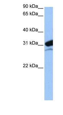 Western Blot: MRPL24 Antibody [NBP1-57354] - 721_B cell lysate, concentration 0.2-1 ug/ml.
