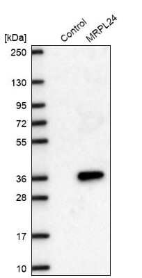 Western Blot: MRPL24 Antibody [NBP2-68709] - Analysis in control (vector only transfected HEK293T lysate) and MRPL24 over-expression lysate (Co-expressed with a C-terminal myc-DDK tag (~3.1 kDa) in mammalian HEK293T cells).