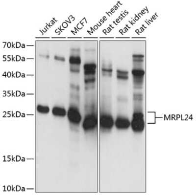 Western Blot: MRPL24 Antibody [NBP2-93354] - Analysis of extracts of various cell lines, using MRPL24 at 1:1000 dilution.Secondary antibody: HRP Goat Anti-Rabbit IgG (H+L) at 1:10000 dilution.Lysates/proteins: 25ug per lane.Blocking buffer: 3% nonfat dry milk in TBST.Detection: ECL Basic Kit .Exposure time: 1s.