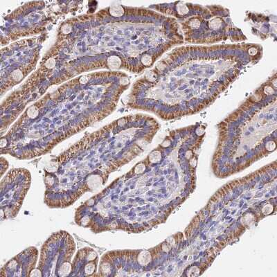 Immunohistochemistry-Paraffin: MRPL3 Antibody [NBP2-13613] - Staining of human duodenum shows moderate cytoplasmic positivity in glandular cells.