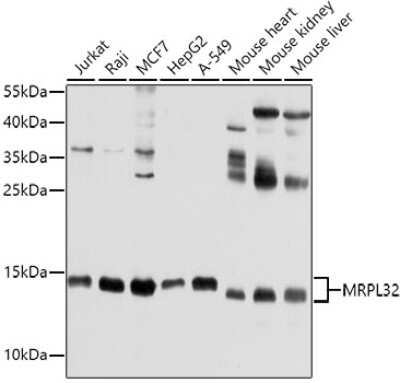 Western Blot: MRPL32 Antibody [NBP2-95121] - Analysis of extracts of various cell lines, using MRPL32 at 1:1000 dilution.Secondary antibody: HRP Goat Anti-Rabbit IgG (H+L) at 1:10000 dilution.Lysates/proteins: 25ug per lane.Blocking buffer: 3% nonfat dry milk in TBST.Detection: ECL Basic Kit .Exposure time: 10s.
