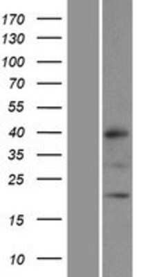 Western Blot: MRPL32 Overexpression Lysate (Adult Normal) [NBP2-06107] Left-Empty vector transfected control cell lysate (HEK293 cell lysate); Right -Over-expression Lysate for MRPL32.