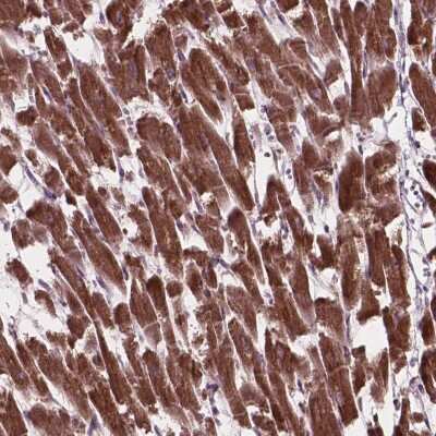 Immunohistochemistry: MRPL33 Antibody [NBP2-49496] - Staining of human heart muscle shows strong cytoplasmic positivity in myocytes.