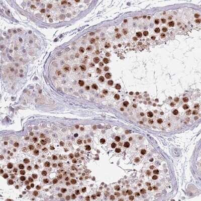 Immunohistochemistry-Paraffin: MRPL34 Antibody [NBP2-13616] - Staining of human testis shows strong nuclear positivity in subset of cells in seminiferus ducts.