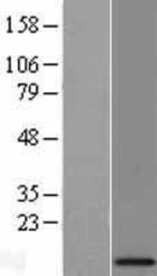 Western Blot: MRPL34 Overexpression Lysate (Adult Normal) [NBL1-13259] Left-Empty vector transfected control cell lysate (HEK293 cell lysate); Right -Over-expression Lysate for MRPL34.