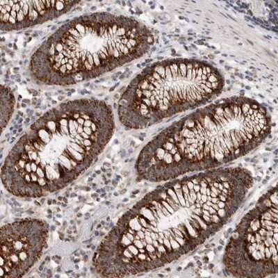 Immunohistochemistry-Paraffin: MRPL37 Antibody [NBP1-82621] - Staining of human colon shows strong cytoplasmic positivity in glandular cells.