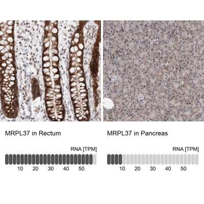 <b>Independent Antibodies Validation and Orthogonal Strategies Validation.</b>Immunohistochemistry-Paraffin: MRPL37 Antibody [NBP1-82621] - Staining in human rectum and pancreas tissues using anti-MRPL37 antibody. Corresponding MRPL37 RNA-seq data are presented for the same tissues.