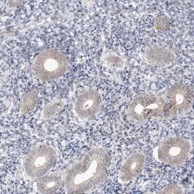 Immunohistochemistry-Paraffin: MRPL37 Antibody [NBP1-82622] - Staining of human endometrium shows weak cytoplasmic positivity in glandular cells.