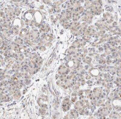<b>Independent Antibodies Validation. </b>Immunohistochemistry-Paraffin: MRPL37 Antibody [NBP1-82622] - Staining of human pancreas shows weak granular cytoplasmic positivity in exocrine glandular cells.