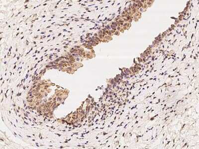 Immunohistochemistry-Paraffin: MRPL37 Antibody [NBP2-97852] - Immunochemical staining of human MRPL37 in human urinary bladder with rabbit polyclonal antibody at 1:100 dilution, formalin-fixed paraffin embedded sections.