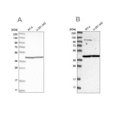 Western Blot: MRPL37 Antibody [NBP1-82621] - Analysis using Anti-MRPL37 antibody NBP1-82621 (A) shows similar pattern to independent antibody NBP1-82622 (B).