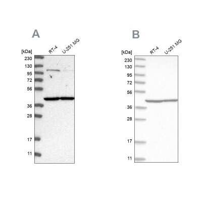 Western Blot: MRPL37 Antibody [NBP1-82622] - Analysis using Anti-MRPL37 antibody NBP1-82622 (A) shows similar pattern to independent antibody NBP1-82621 (B).
