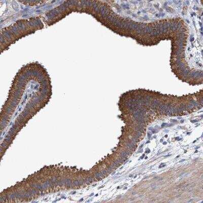 <b>Independent Antibodies Validation. </b>Immunohistochemistry: MRPL38 Antibody [NBP1-81673] - Staining of human gallbladder shows moderate cytoplasmic positivity in glandular cells.