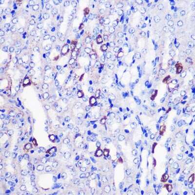Immunohistochemistry-Paraffin: MRPL38 Antibody [NBP2-93579] - Immunohistochemistry of paraffin-embedded Mouse kidney using MRPL38 Rabbit pAb (NBP2-93579) at dilution of 1:100 (40x lens). Perform microwave antigen retrieval with 10 mM PBS buffer pH 7.2 before commencing with IHC staining protocol.