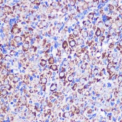 Immunohistochemistry-Paraffin: MRPL38 Antibody [NBP2-93579] - Immunohistochemistry of paraffin-embedded Rat ovary using MRPL38 Rabbit pAb (NBP2-93579) at dilution of 1:100 (40x lens). Perform microwave antigen retrieval with 10 mM PBS buffer pH 7.2 before commencing with IHC staining protocol.