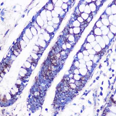 Immunohistochemistry-Paraffin: MRPL38 Antibody [NBP2-93579] - Immunohistochemistry of paraffin-embedded Human colon using MRPL38 Rabbit pAb (NBP2-93579) at dilution of 1:100 (40x lens). Perform microwave antigen retrieval with 10 mM PBS buffer pH 7.2 before commencing with IHC staining protocol.