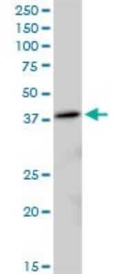 Western Blot: MRPL38 Antibody [H00064978-B01P] - Analysis of MRPL38 expression in A-431.