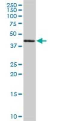 Western Blot: MRPL38 Antibody [H00064978-B01P] - Analysis of MRPL38 expression in human placenta.