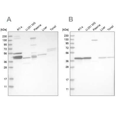 Western Blot: MRPL38 Antibody [NBP1-81673] - Analysis using Anti-MRPL38 antibody NBP1-81673 (A) shows similar pattern to independent antibody NBP1-81672 (B).